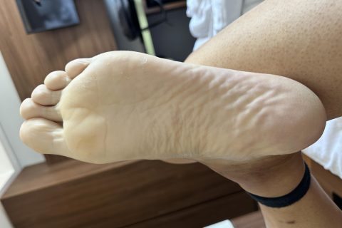捆绑血液不流通的阶段变化