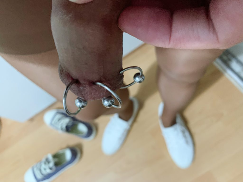 包皮拉伸【多图+视频】