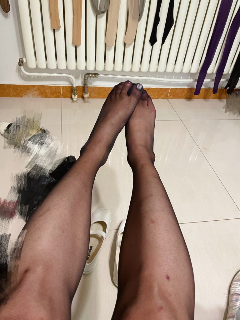 猫眼