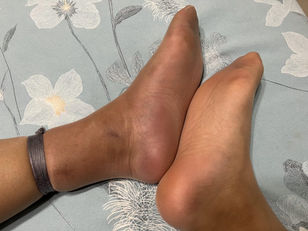 小小的皮筋脚都给我勒肿了