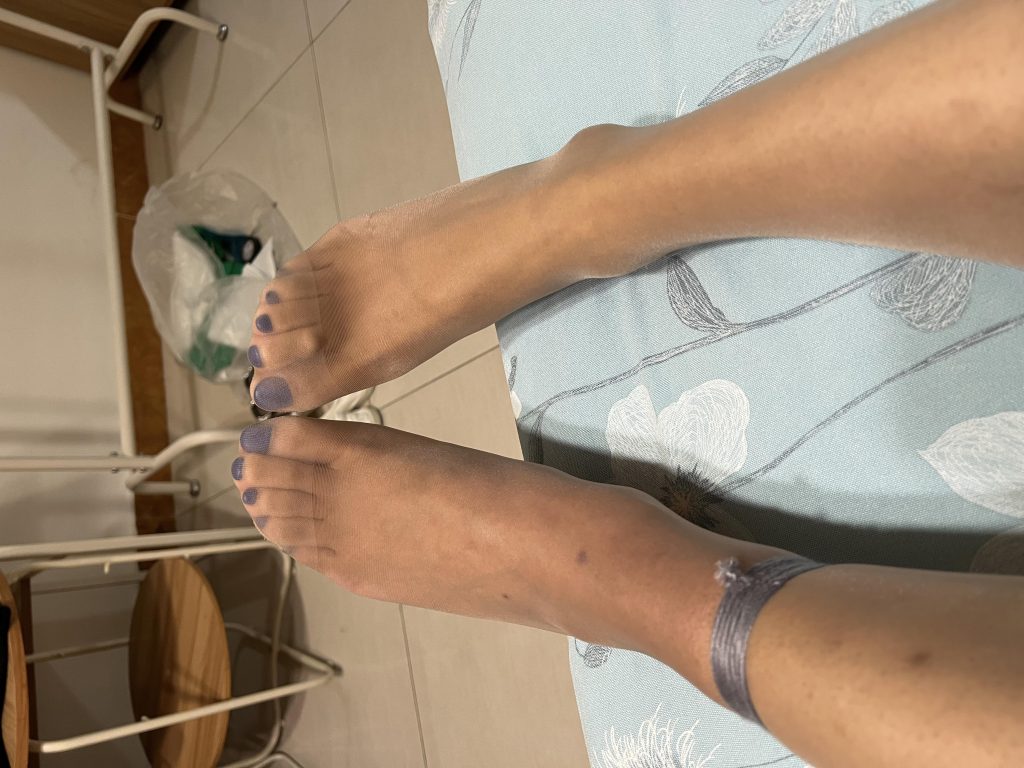 小小的皮筋脚都给我勒肿了