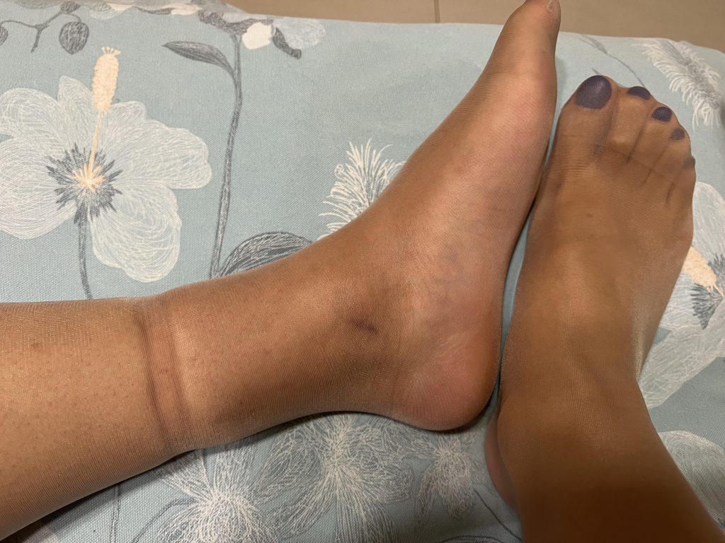 小小的皮筋脚都给我勒肿了