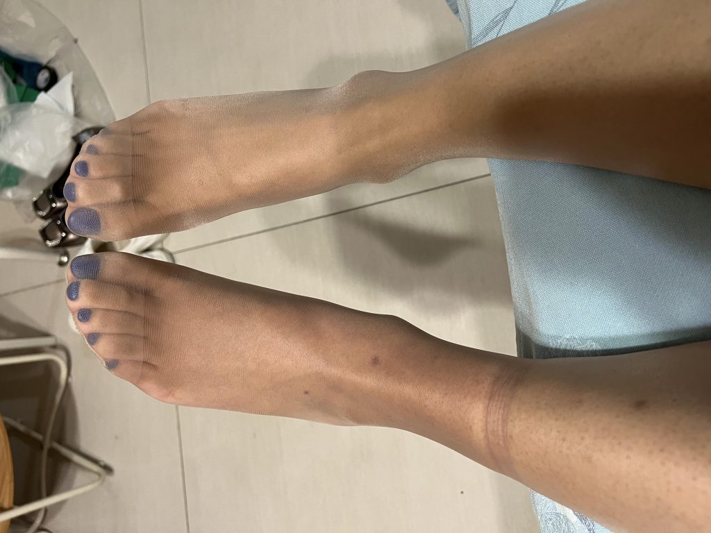 小小的皮筋脚都给我勒肿了
