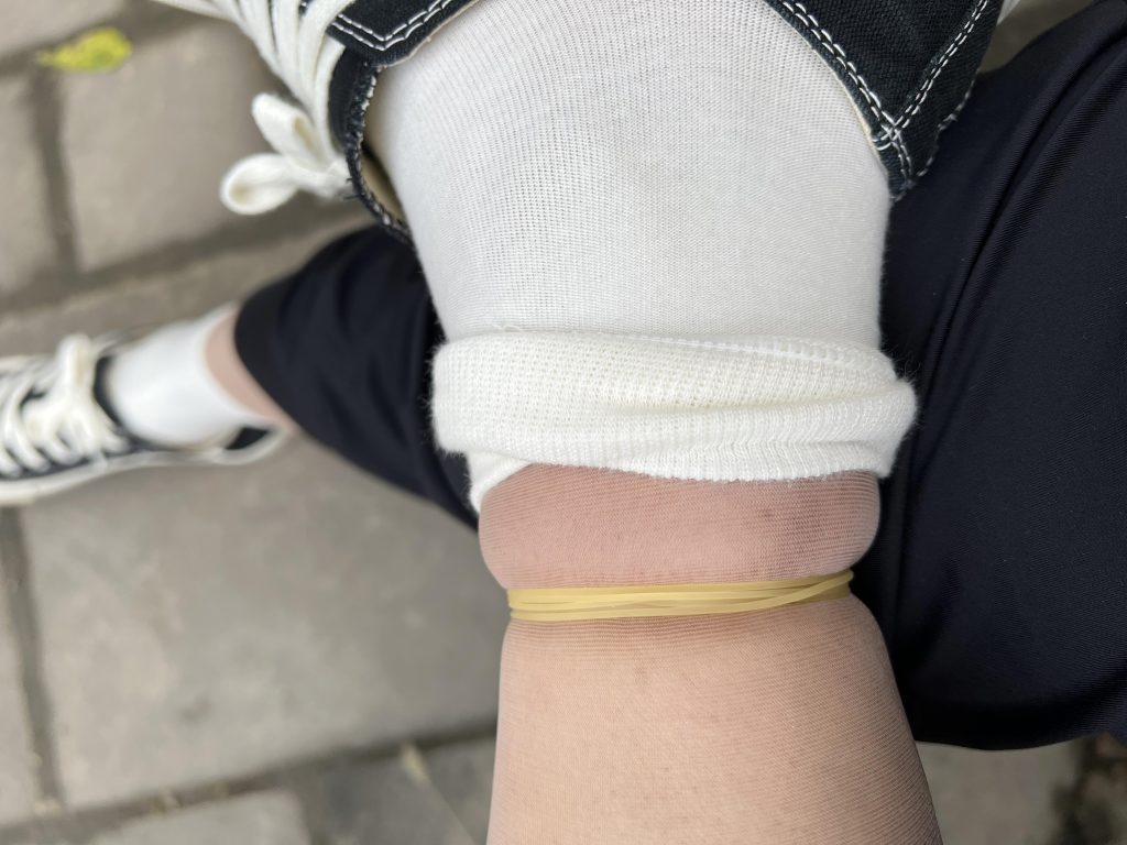 小小的皮筋脚都给我勒肿了