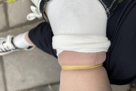 小小的皮筋脚都给我勒肿了