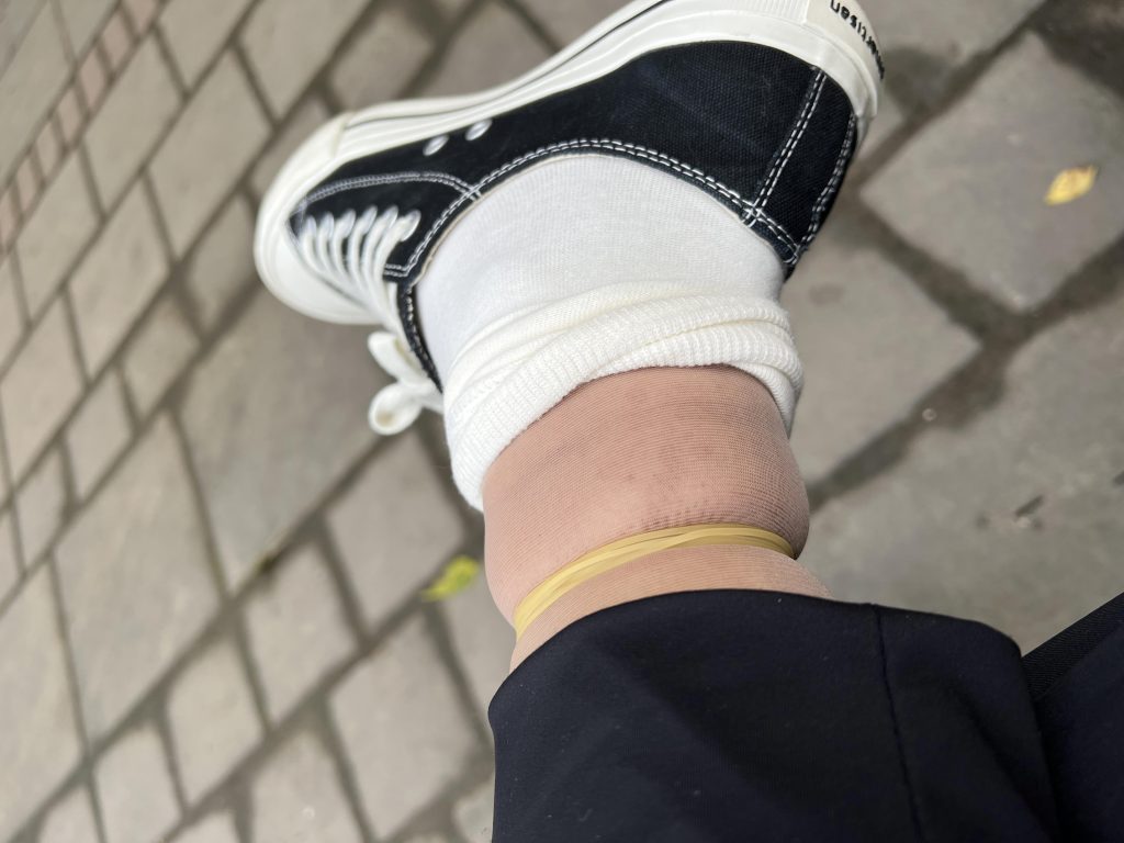 小小的皮筋脚都给我勒肿了
