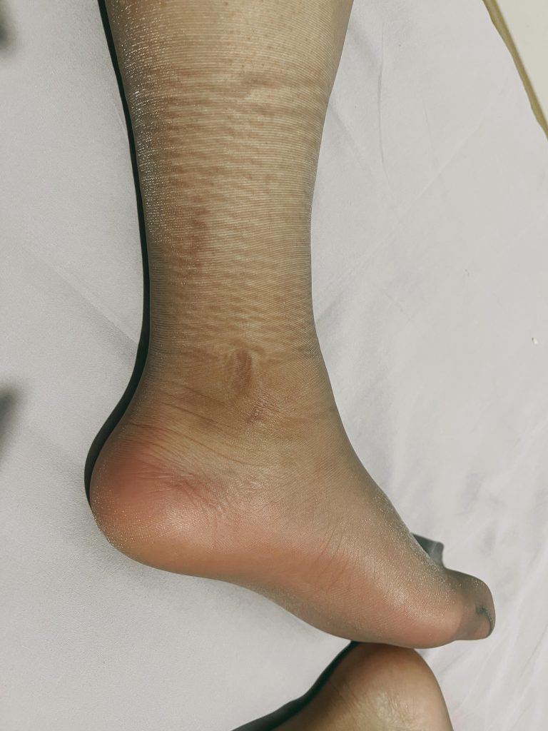 喝多了干的啥事儿，勒死拉倒的心态