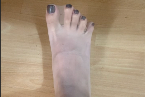 左腿被绑了右腿还不老实